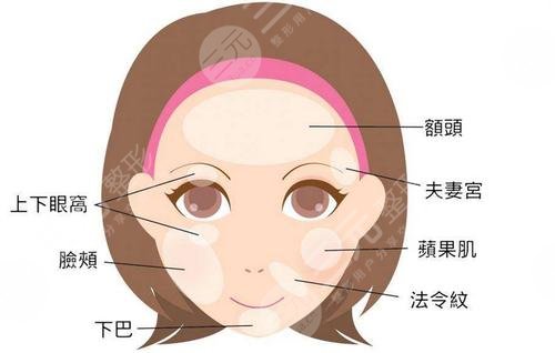內窺鏡除皺手術大概多少錢