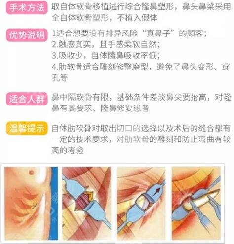 隆鼻