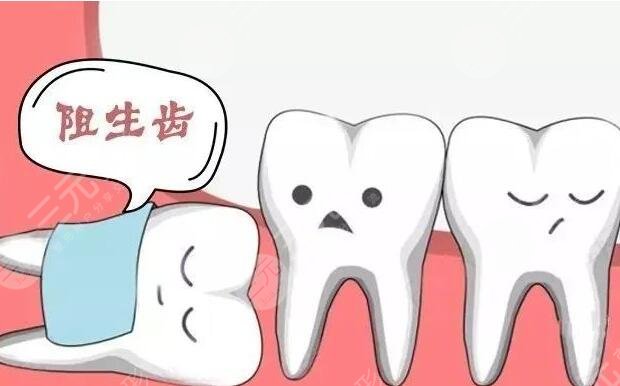 拔智齒