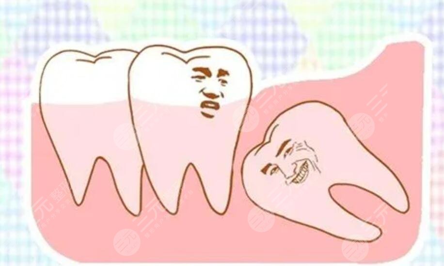 拔智齒