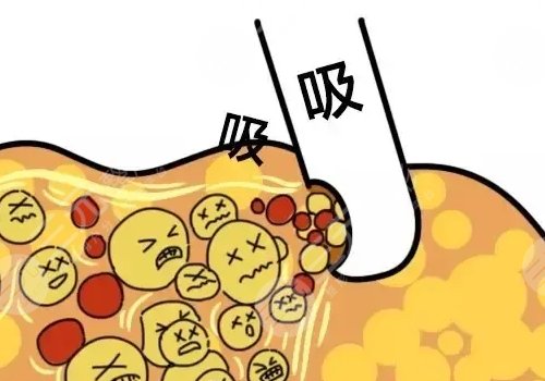 佛山市第二人民醫(yī)院醫(yī)學(xué)美容科鼻整形專(zhuān)家