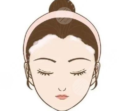 發(fā)際線種植