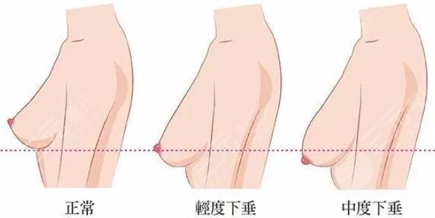 乳房