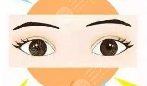 雙眼皮