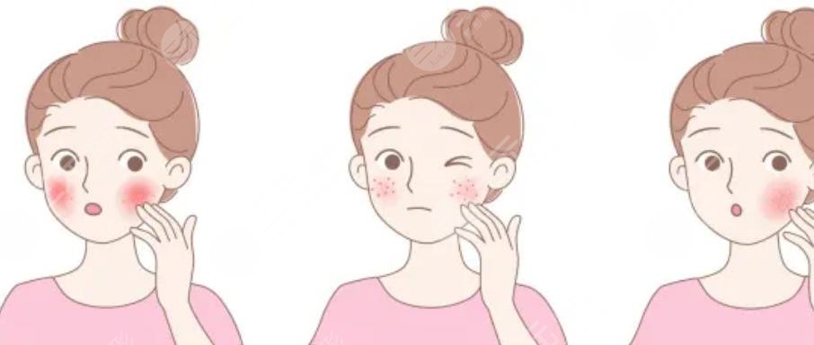 嫩膚
