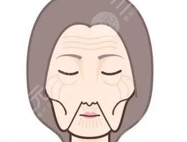 拉皮手術(shù)