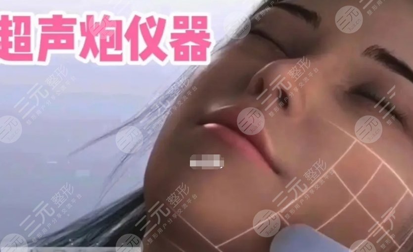超聲炮