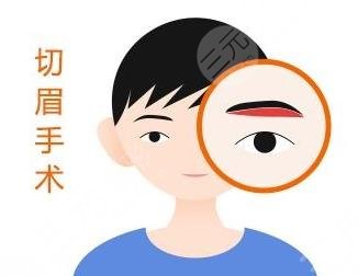 切眉