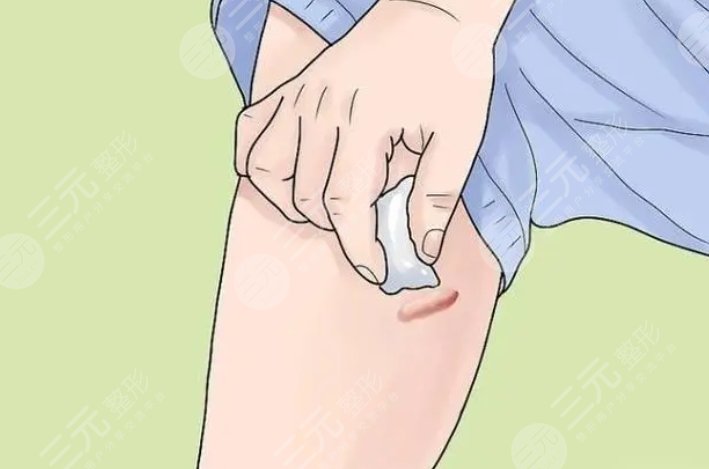 疤痕大腿