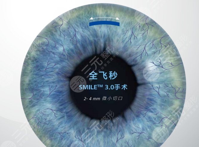 飛秒