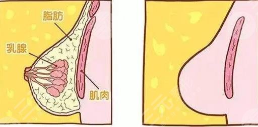 巨乳縮小