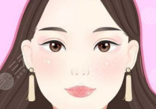卜勝利雙眼皮案例