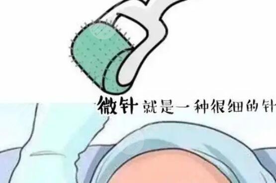 微針