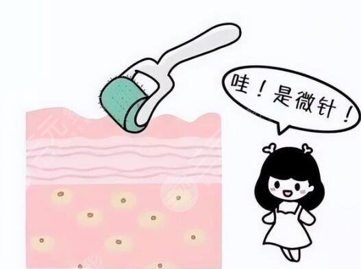 微針