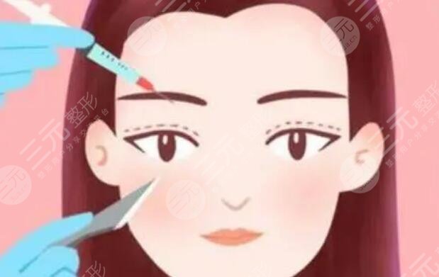 雙眼皮