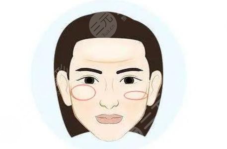 顴骨