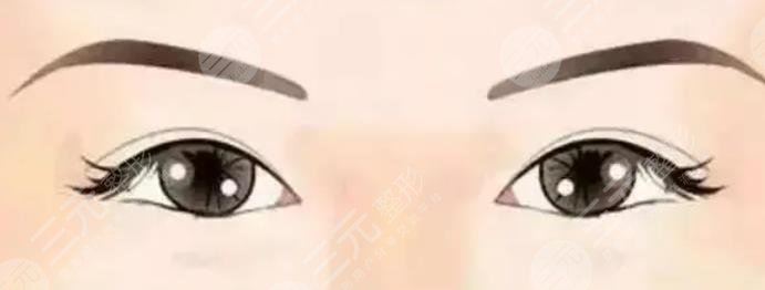 雙眼皮