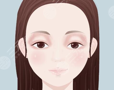 雙眼皮