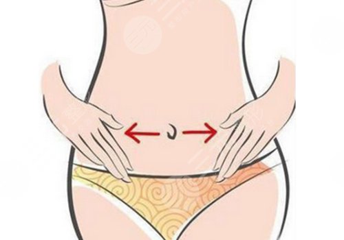 吸脂腰腹部需要休息幾天