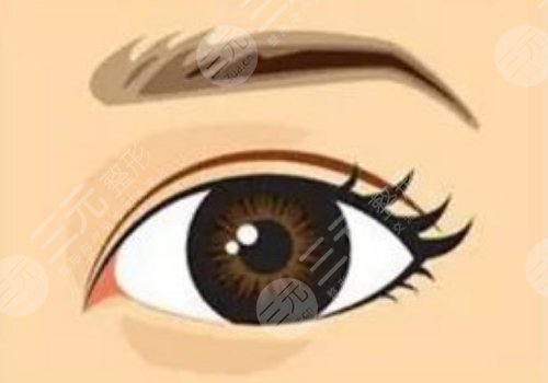 切雙眼皮修復(fù)手術(shù)多少錢