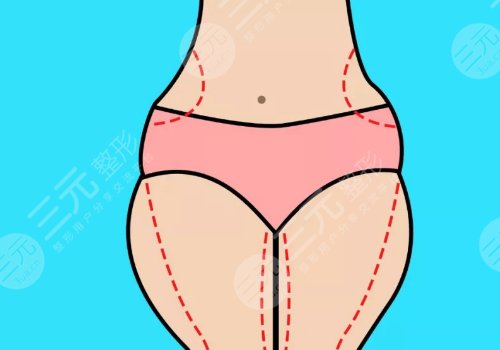 大腿抽脂的價(jià)格
