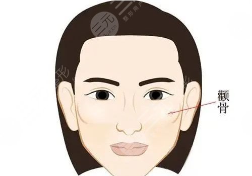顴骨高怎么整容