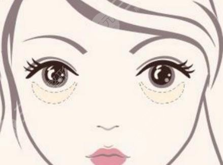 眼袋