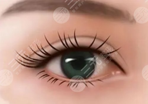 修復(fù)雙眼皮的價格