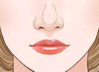 鼻基底