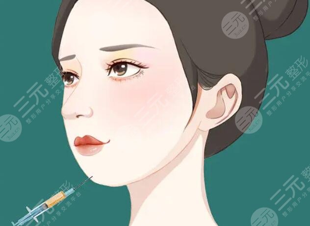 玻尿酸注射