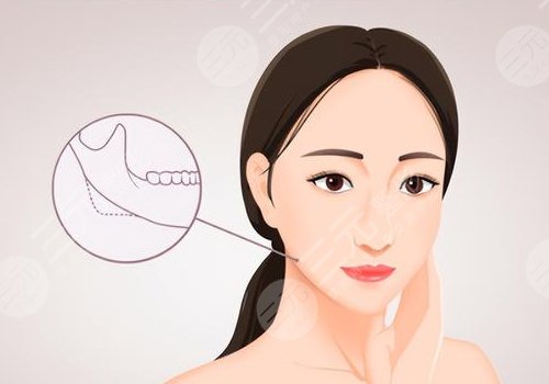 左右下頜骨不對(duì)稱怎么矯正