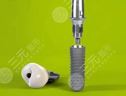 南京(江蘇)省人民醫(yī)院種植牙收費(fèi)標(biāo)準(zhǔn)