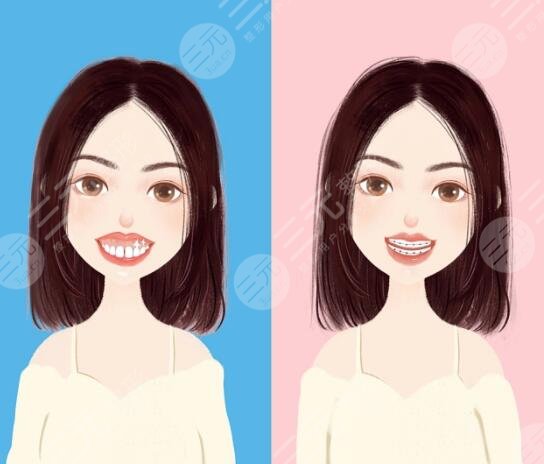 案例說