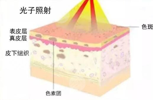 術(shù)后小tips