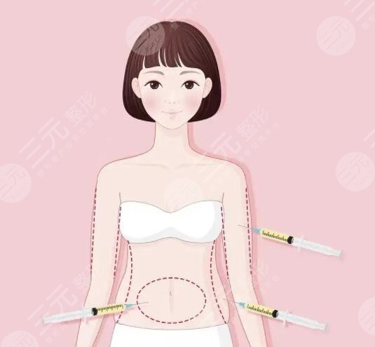 重慶醫(yī)科大學附屬第一醫(yī)院抽脂價格表