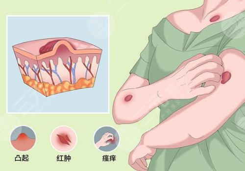 河南中醫(yī)藥大學第一附屬醫(yī)院整形外科瘢痕疙瘩