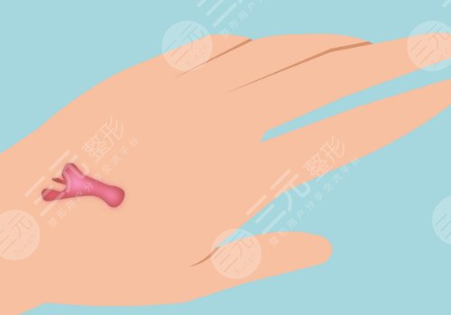 河南中醫(yī)藥大學第一附屬醫(yī)院整形外科瘢痕疙瘩