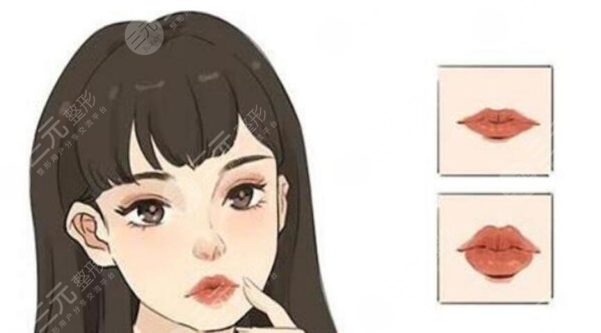 紋唇