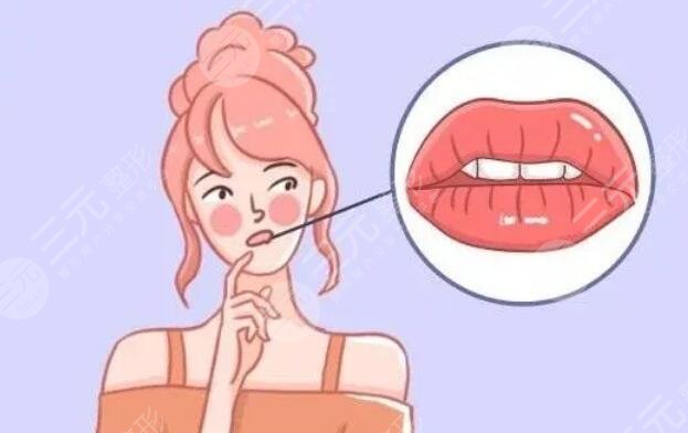 紋唇