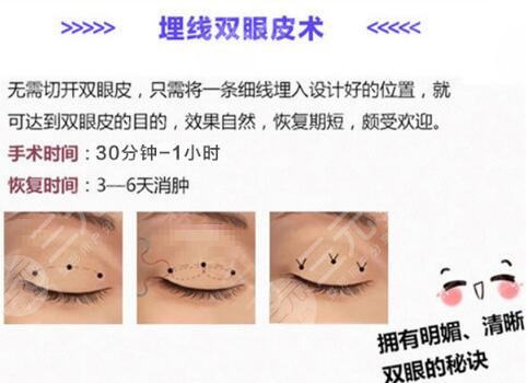 雙眼皮