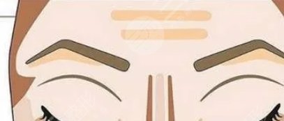眉弓