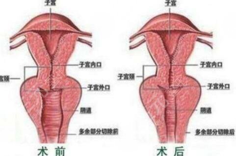 私密整形