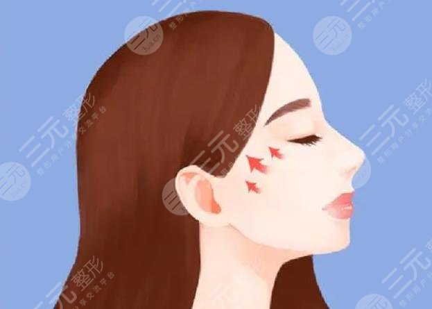 顴骨內(nèi)推