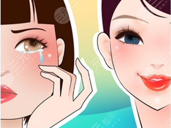 面部吸脂
