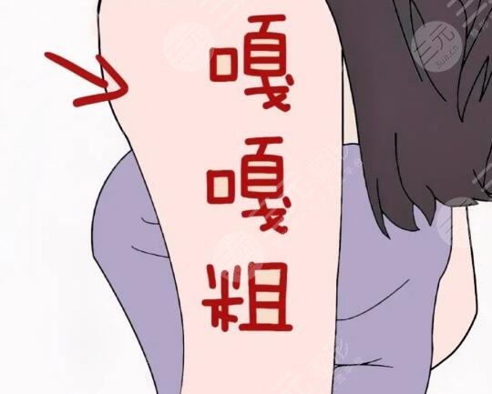手臂吸脂