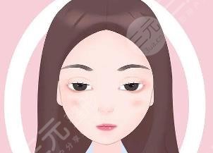 上瞼下垂