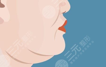 雙下巴
