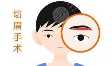 提眉
