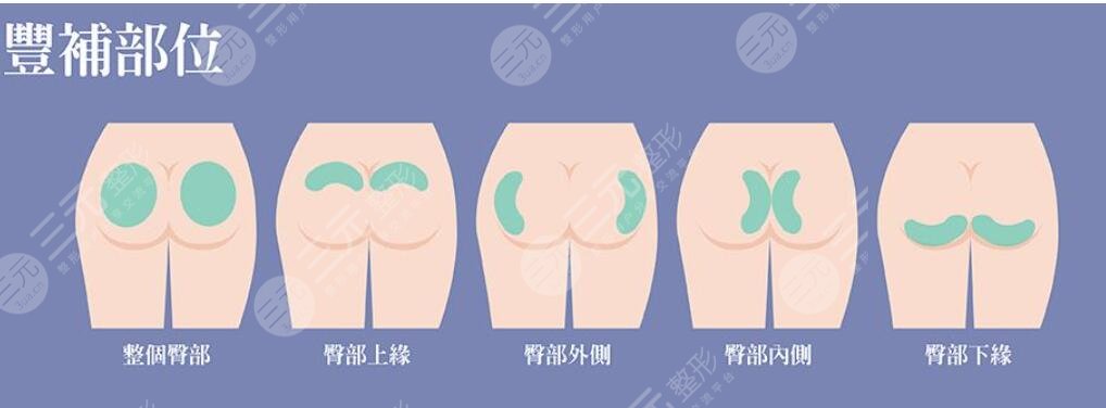 豐臀