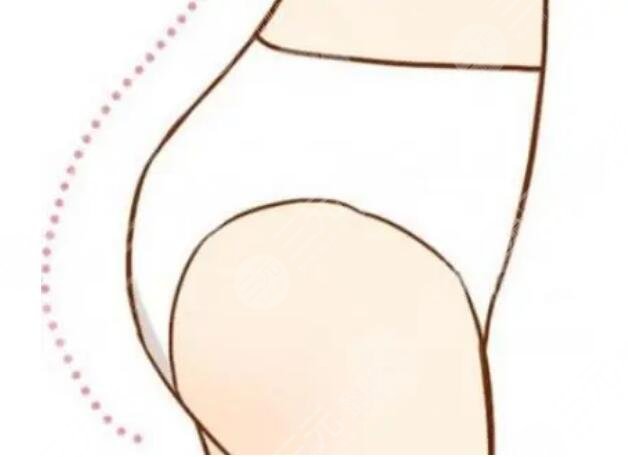豐臀